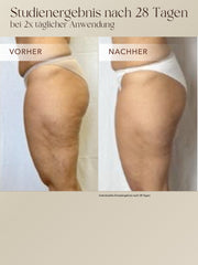 Anti-Cellulite 3-Monats-Kur