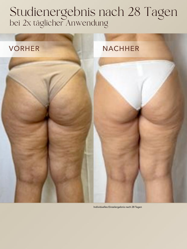 Anti-Cellulite 3-Monats-Kur