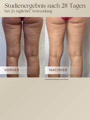 Anti-Cellulite 3-Monats-Kur