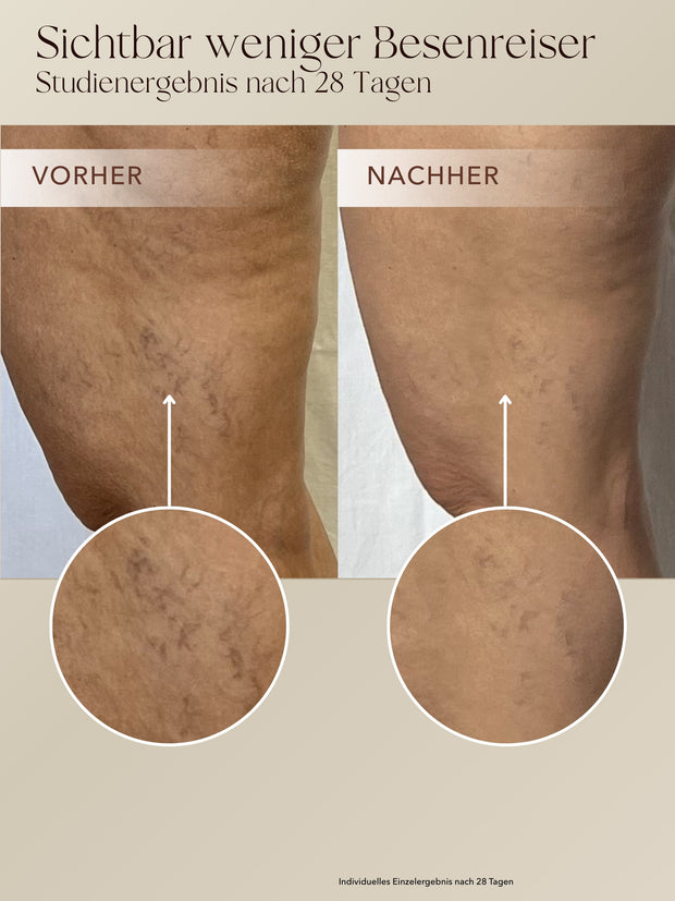 Anti-Cellulite 3-Monats-Kur