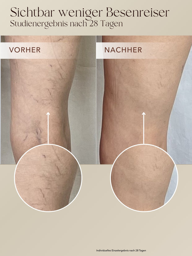 Anti-Cellulite 3-Monats-Kur