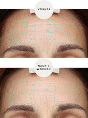 XTREME Brightening Booster