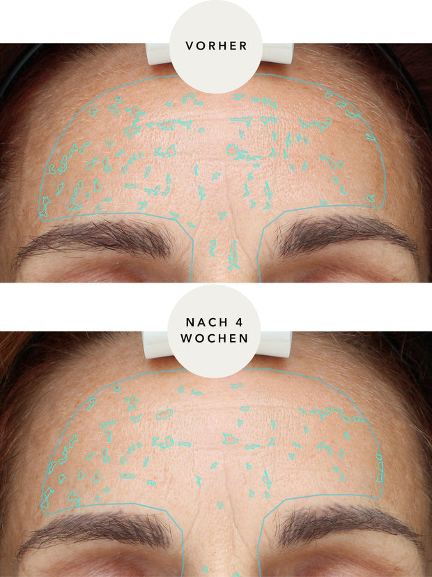 XTREME Brightening Booster
